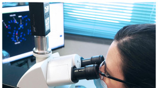 La proteina chiave dell'Alzheimer si propaga attraverso i neuroni