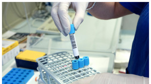 Il sistema immunitario di uomini e donne funziona in modo diverso