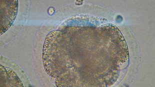 L'invecchiamento rimodella le cellule dei mammiferi