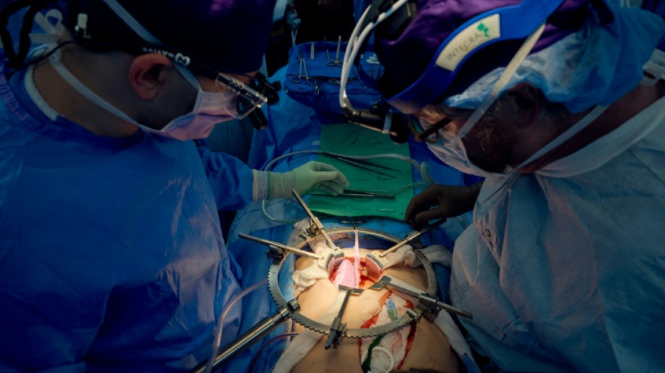 US surgeons say pig kidney functional in human for more than a month