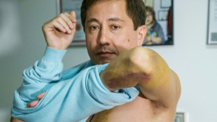 En Kazajist&aacute;n, las torturas ponen en duda la versi&oacute;n oficial de los disturbios