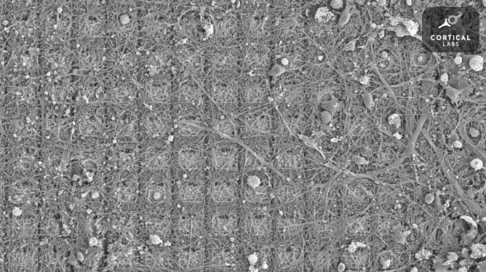 Des neurones dou&eacute;s de sensations ont appris &agrave; jouer &agrave; un jeu vid&eacute;o