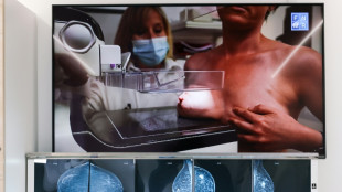 Decenas de mujeres sufrieron atenci&oacute;n deficiente de c&aacute;ncer de mama en la regi&oacute;n de Inglaterra